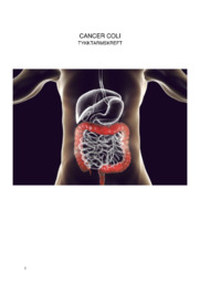 Cancer coli | Helse- og sosialfag